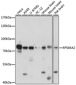 RSK3 (RPS6KA2) Rabbit Polyclonal Antibody - image 1