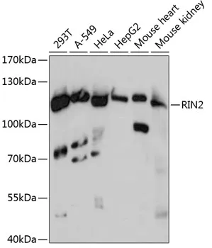 RIN2 Rabbit Polyclonal Antibody - image 1