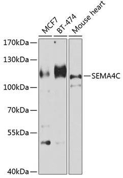 SEMA4C Rabbit Polyclonal Antibody - image 1