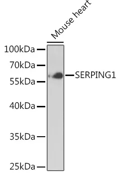 SERPING1 Rabbit Polyclonal Antibody - image 1