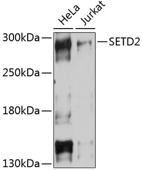 SETD2 Rabbit Polyclonal Antibody - image 1