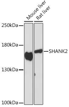 SHANK2 Rabbit Polyclonal Antibody - image 1