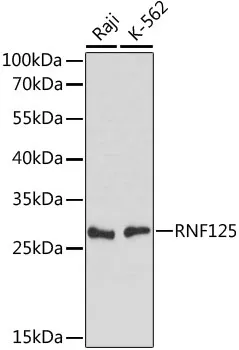 RNF125 Rabbit Polyclonal Antibody - image 1