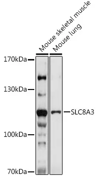 SLC8A3 Rabbit Polyclonal Antibody - image 1