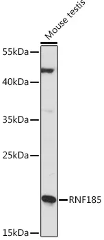 RNF185 Rabbit Polyclonal Antibody - image 1