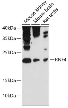 RNF4 Rabbit Polyclonal Antibody - image 1