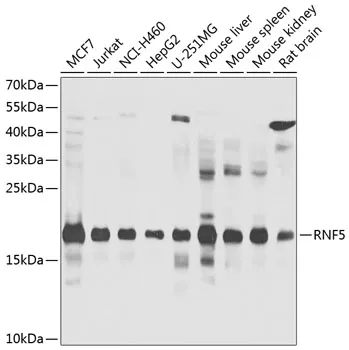 RNF5 Rabbit Polyclonal Antibody - image 1