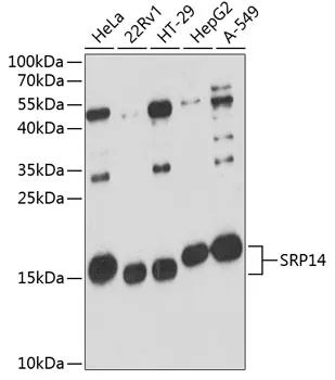SRP14 Rabbit Polyclonal Antibody - image 1