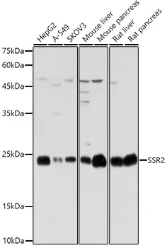 SSR2 Rabbit Polyclonal Antibody - image 1