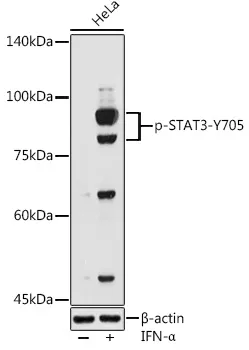 STAT3 Rabbit Polyclonal Antibody - image 1