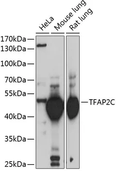 AP2 gamma (TFAP2C) Rabbit Polyclonal Antibody - image 1