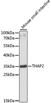 THAP2 Rabbit Polyclonal Antibody - image 1