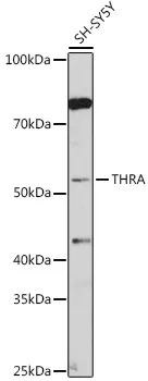Thyroid Hormone Receptor alpha (THRA) Rabbit Polyclonal Antibody - image 1
