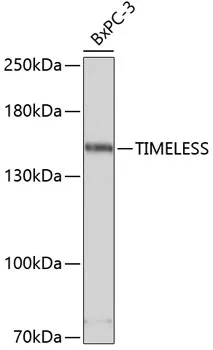 TIMELESS Rabbit Polyclonal Antibody - image 1