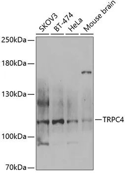 TRPC4 Rabbit Polyclonal Antibody - image 1