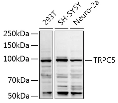 TRPC5 Rabbit Polyclonal Antibody - image 1