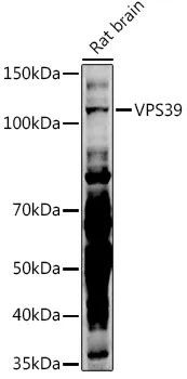 VPS39 Rabbit Polyclonal Antibody - image 1