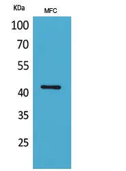 ACTC1 Rabbit Polyclonal Antibody - image 1