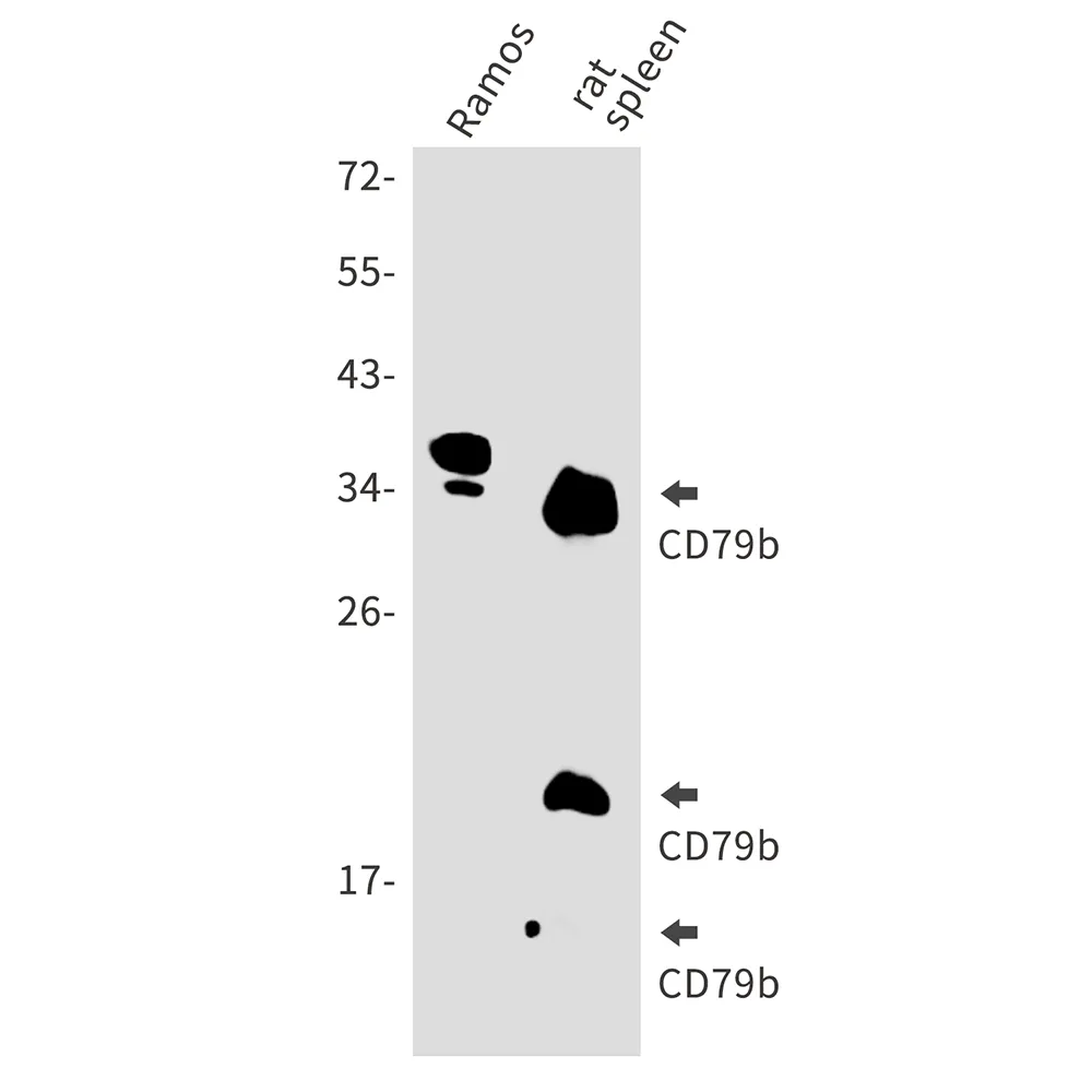CD79B Rabbit Polyclonal Antibody - image 1