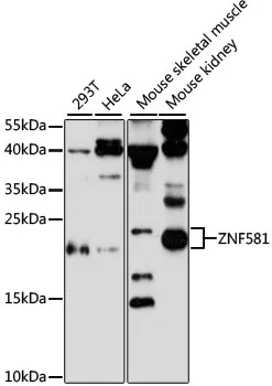 ZNF581 Rabbit Polyclonal Antibody - image 1