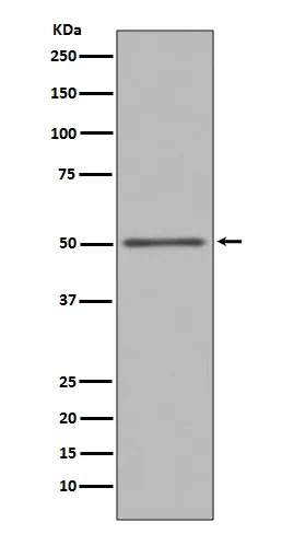 FOXA1 Rabbit Polyclonal Antibody - image 1
