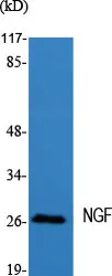 NGF Rabbit Polyclonal Antibody - image 1