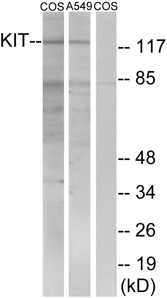 CD117 Rabbit Polyclonal Antibody - image 1