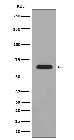 PAK3 Rabbit Polyclonal Antibody - image 1