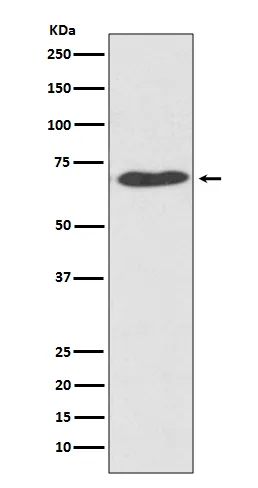 PDIA2 Rabbit Polyclonal Antibody - image 1