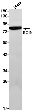 RRAS Rabbit Monoclonal Antibody [Clone ID: R06-7A2] - image 1