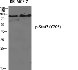 STAT3 Rabbit Polyclonal Antibody - image 1