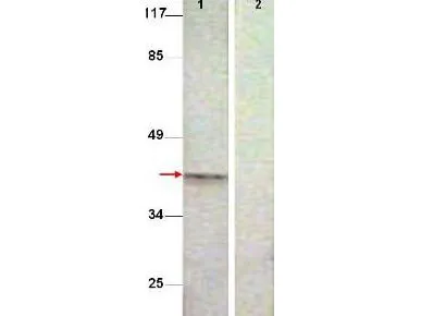 Aurora B (AURKB) Rabbit Polyclonal Antibody - image 1