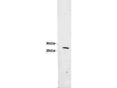 DsRed Chicken Polyclonal Antibody - image 1