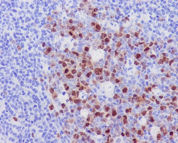 Aurora B (AURKB) Rabbit Monoclonal Antibody - image 1