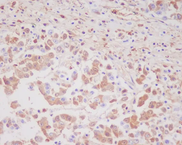 MMP9 Rabbit Monoclonal Antibody - image 1
