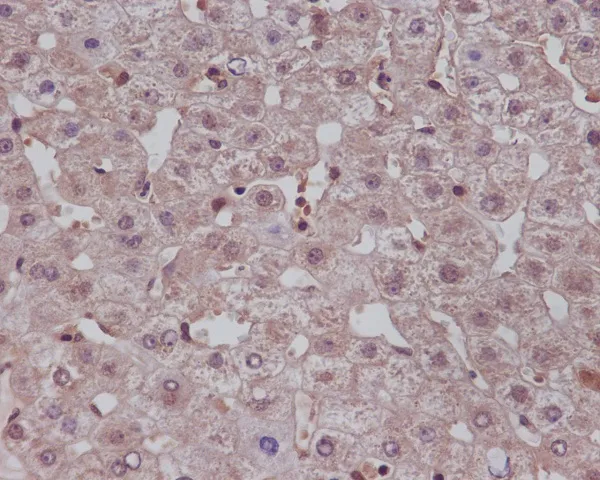NOTCH1 Rabbit Monoclonal Antibody - image 1