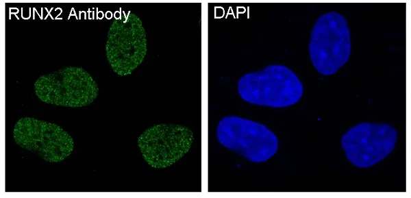 RUNX2 Rabbit Monoclonal Antibody - image 1