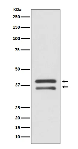 MEK3 (MAP2K3) Rabbit Monoclonal Antibody - image 1