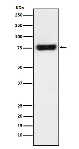 MTA2 Rabbit Monoclonal Antibody - image 1