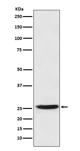 Prostaglandin dehydrogenase 1 (HPGD) Rabbit Monoclonal Antibody - image 1