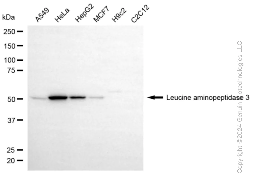 LAP3 Rabbit Monoclonal Antibody [Clone ID: 24GB5965] - image 1
