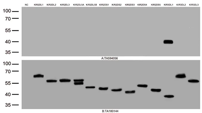 KIR3DL1 Rabbit Monoclonal Antibody [Clone ID: OTIR1A9] - image 1