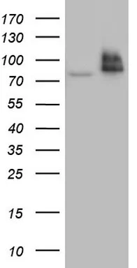 RRM1 Mouse Monoclonal Antibody (HRP conjugated) [Clone ID: OTI16A8] - image 1