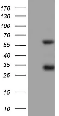 Mesothelin (MSLN) Mouse Monoclonal Antibody (HRP conjugated) [Clone ID: OTI5B12] - image 1