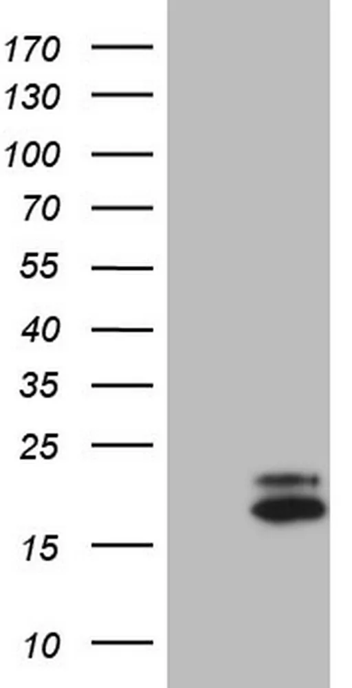 VIP Mouse Monoclonal Antibody (HRP conjugated) [Clone ID: OTI1G1] - image 1