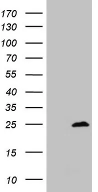 Myosin (MYL4) Mouse Monoclonal Antibody (Biotin conjugated) [Clone ID: OTI5A2] - image 1