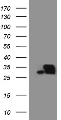 SNRPB2 Mouse Monoclonal Antibody (Biotin conjugated) [Clone ID: OTI3D9] - image 1