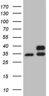 SDHB Mouse Monoclonal Antibody (Biotin conjugated) [Clone ID: OTI1E4] - image 1