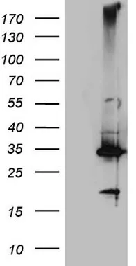 C Reactive Protein (CRP) Mouse Monoclonal Antibody (Biotin conjugated) [Clone ID: OTI7C10] - image 1
