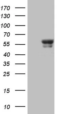 BTBD3 Mouse Monoclonal Antibody (HRP conjugated) [Clone ID: OTI1A10] - image 1